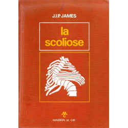 La scoliose